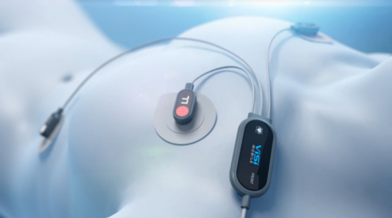 可穿戴设备电池大战：中、日、韩谁领风骚？